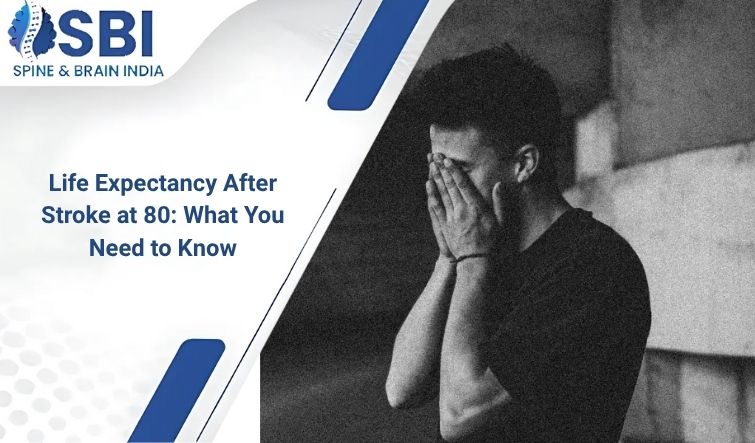 متوسط العمر المتوقع بعد السكتة الدماغية في 80: ما تحتاج إلى معرفته